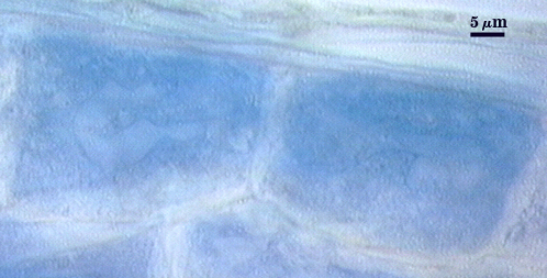 blue stained arbuscules cloudy cell walls