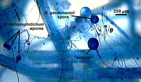 saccule spores in blue