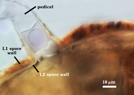 Pedicel, L1 and L2 spore wall