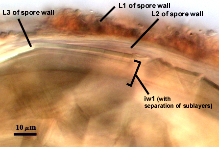L1, L2, and L3 of spore wall with iw1 and separation of sublayers