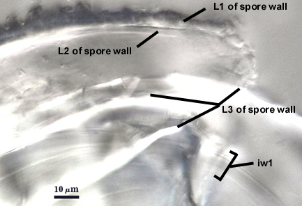 L1, L2 and L3 of spore wall