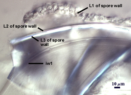 L1, L2, and L3 of spore wall with iw1