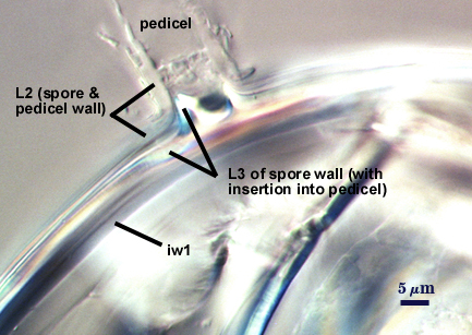 Pedicel, L2 spore & pedicel wall. L3 of spore wall with insertion into pedicel and iw1.