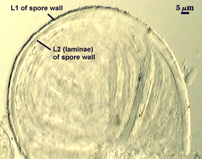L1 and L2 (laminae) of spore wall