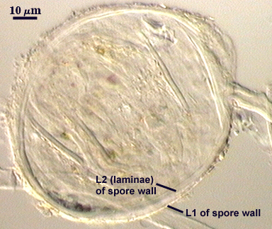 L2 (laminae) and L1 of spore wall