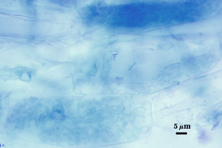 Blue stained roots dark clouds representing leptoticha morph arbuscules