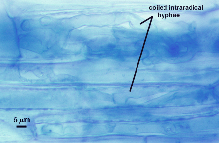 Blue stained roots dark clouds representing leptoticha morph arbuscules with coiled intraradical hyphae