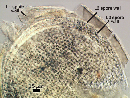 Leptoticha morph in pvlg