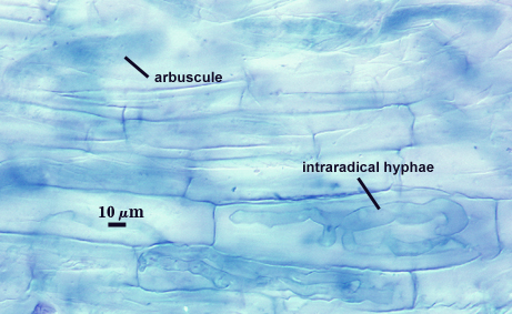 Leptoticha morph mycorrhizal in blue stain