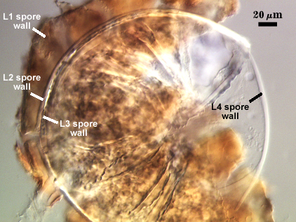 Leptoticha morph with L1 L2 and L3 spore wall