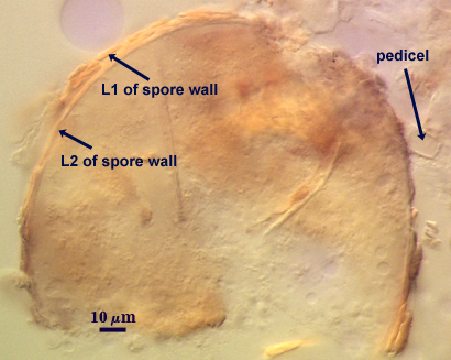 Light orange leptoticha morph with L1 and L2 spore wall
