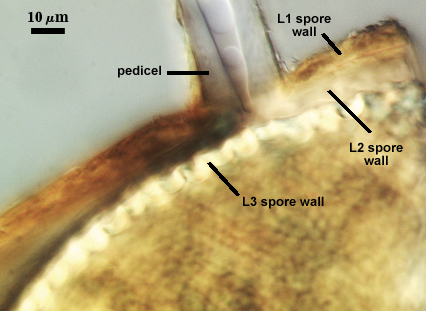 Leptoticha morph with L1 and L2 spore wall pedicel tail