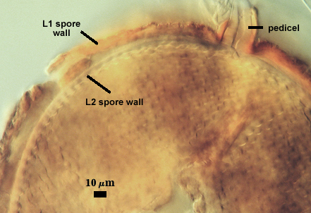 Leptoticha morph with L1 and L2 spore wall pedicel tail