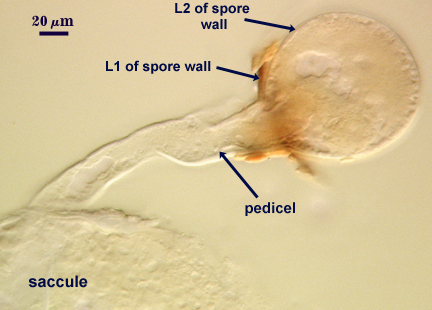 Leptoticha morph with L1 and L2 spore wall