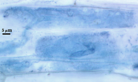 Arbuscules and hyphae in cortical cells blue die