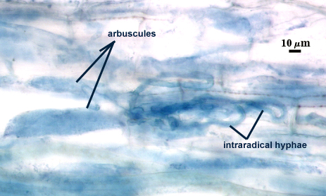 Arbuscules and intraradical hyphae in blue stain