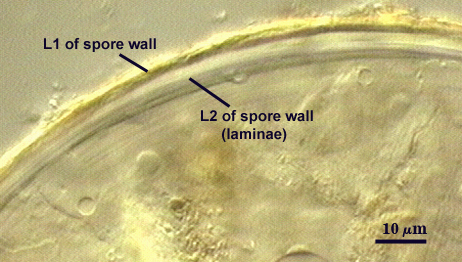 Leptoticha in Melzer's Reagent with L1 and L2 spore wall at 10mm