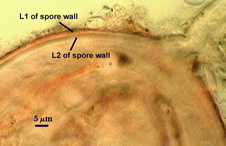 Leptoticha in Melzer's Reagent with L1 and L2 spore wall at 5mm