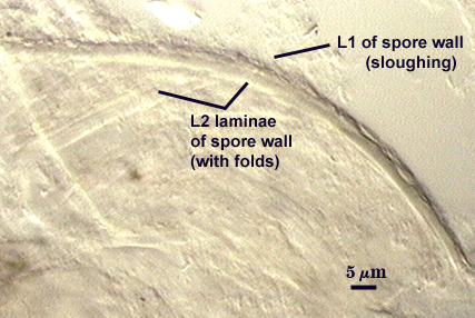 Leptoticha in plvg with L1 and L2 of spore wall with folds