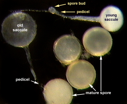 Sporiferous saccule with spore bud and pedicel