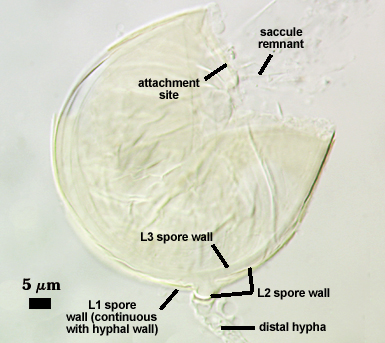 Distal hypha L1 and L3 spore wall attachment site and saccule remnant