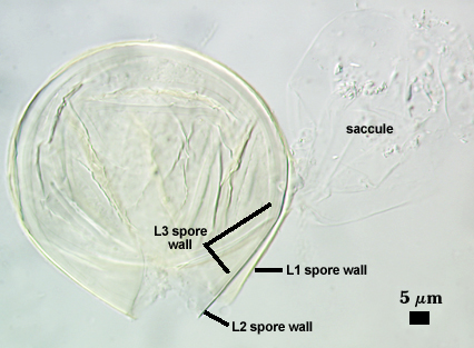 L1 L2 and L3 spore wall and saccule 2