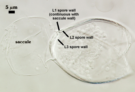L1 L2 and L3 spore wall and saccule