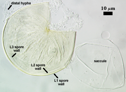 L1 L2 and L3 spore wall saccule and distal hypha 2