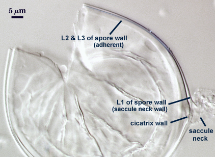 Saccule neck saccule neck wall cicatrix wall L2 and L3 of spore wall