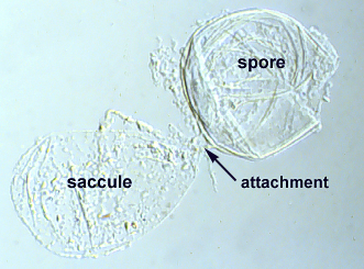 Spore and saccule still attached