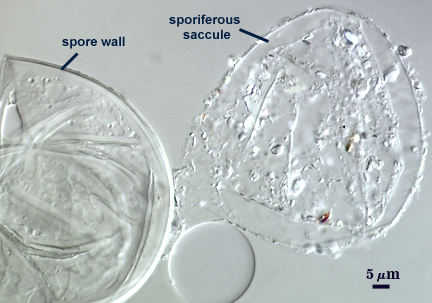 Sporiferous saccule and spore wall