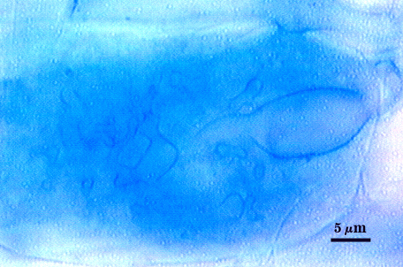 Blue stained roots dark clouds representing arbuscules 3