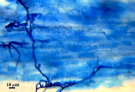 Blue stained roots dark stained strings entry points 2