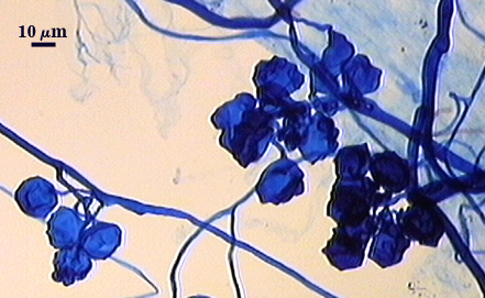 Dark blue stained aggregate cells