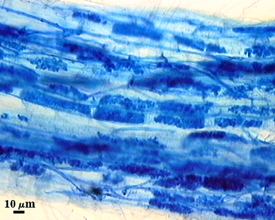 arbuscules many dark spots in lighter root fragment