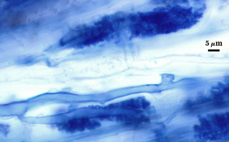 arbuscule in root soft cloud of darker blue filling root cell