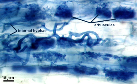 arbuscules many dark spots in lighter root fragment and hyphae dark branching lines between cells