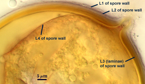 L1 through L4 of spore wall