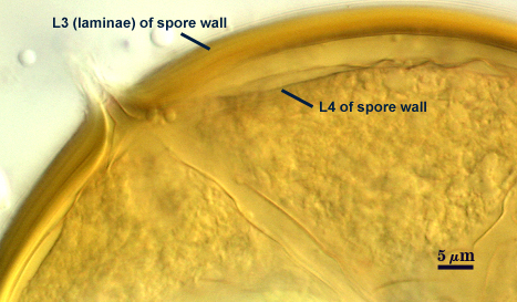 L3 laminae of spore wall and L4 of spore wall
