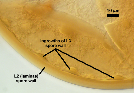 maculosum L2 laminae spore wall ingrowths of L3 spore wall