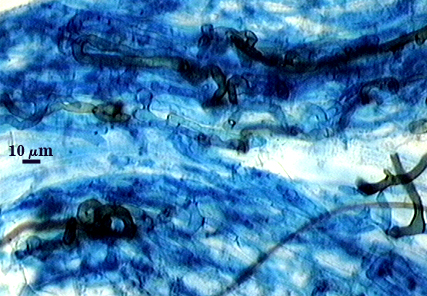 Hypha dark blue organic lines