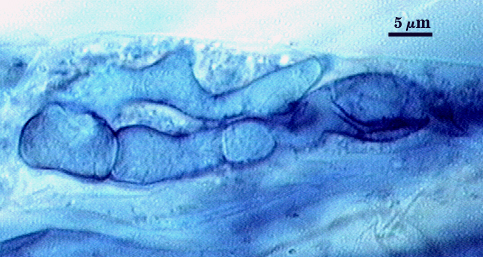 Arbuscule in root soft cloud of darker blue filling root cell 2