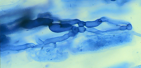 Arbuscule in root soft cloud of darker blue filling root cell 2