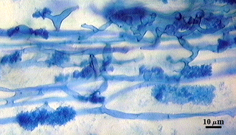 Arbuscule in root soft clouds of darker blue filling root cells Hyphae organic lines