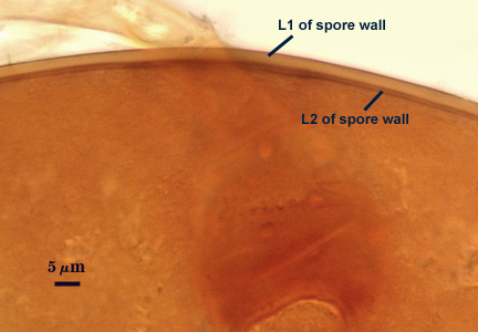 L1 L2 spore wall curved lines