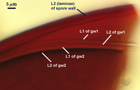 L2 sw laminae inner L1 L2 of gw1 and gw2 