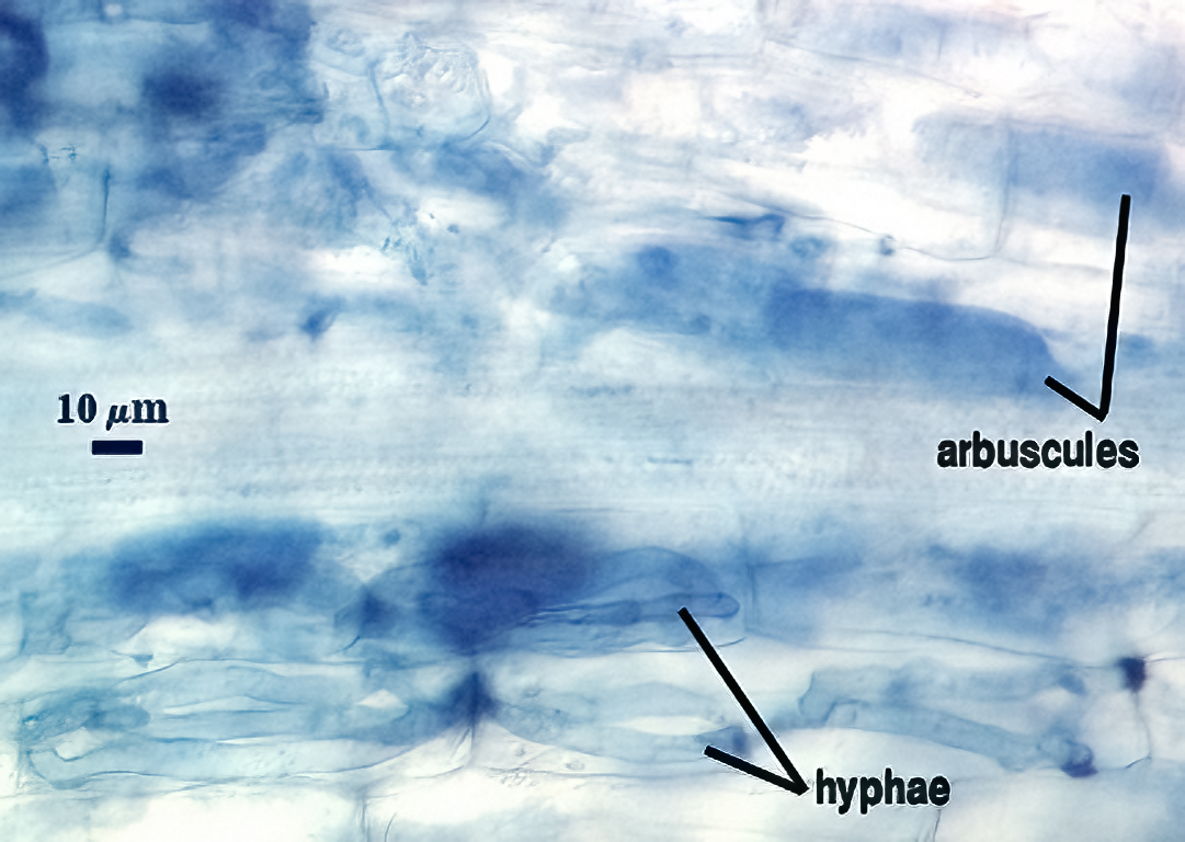Blue stained curvilinear hyphae between root cells