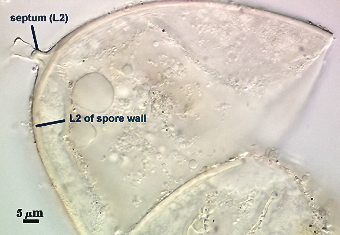 Smashed sphere L2 forms septum between spore and hyphae 2