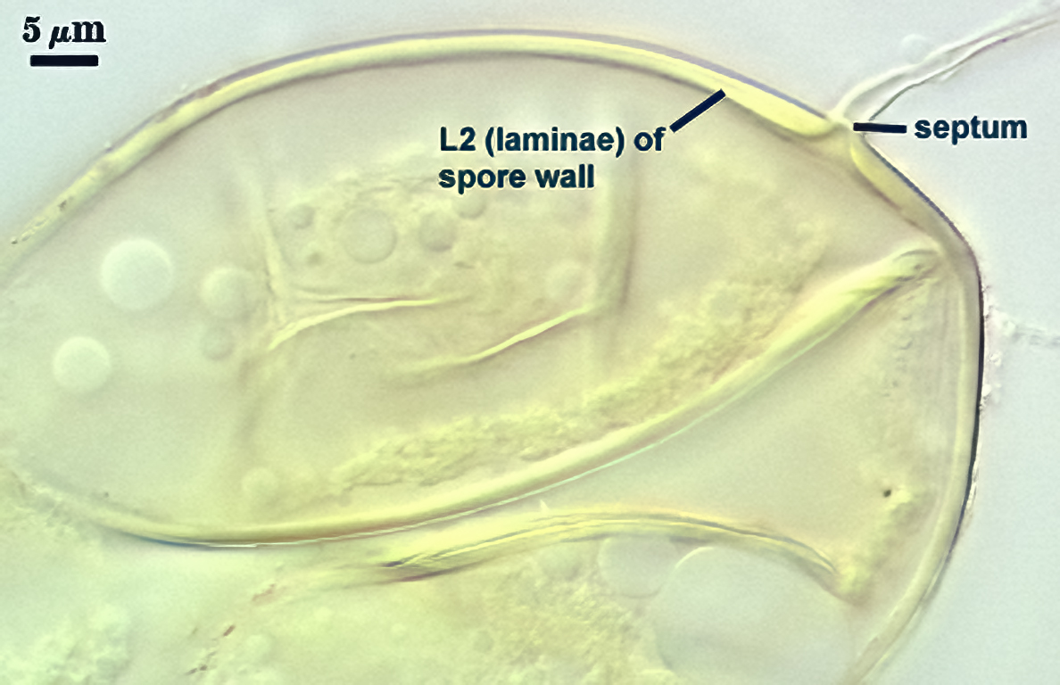 Smashed sphere L2 forms septum between spore and hyphae 3