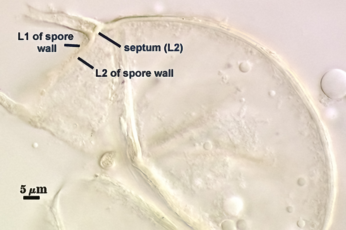 Smashed sphere L2 forms septum between spore and hyphae